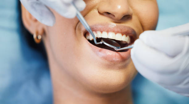 Best Emergency Root Canal Treatment in Roselle, IL