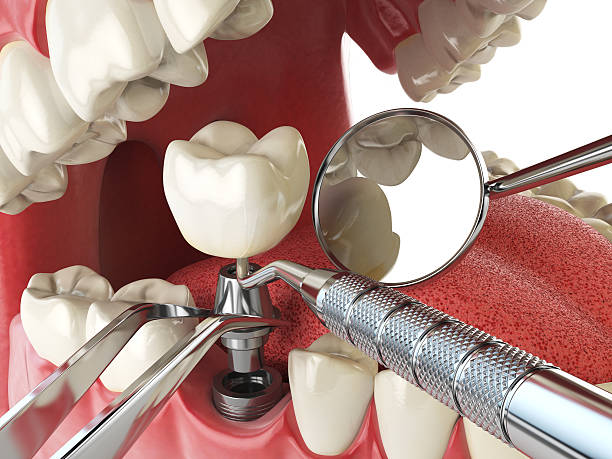 Best Holiday Emergency Dentist in Roselle, IL